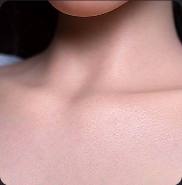 Collarbone skin grain